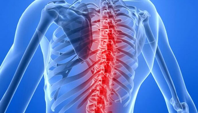 Las patologías de la columna son las causas más comunes de dolor de espalda en la zona de la escápula. 