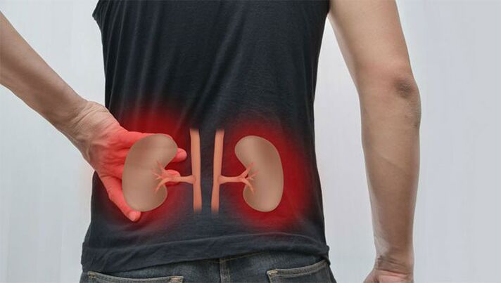 dolor lumbar debido a una enfermedad renal