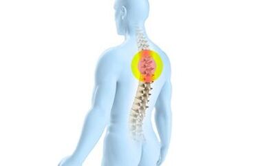 osteocondrosis de la columna torácica