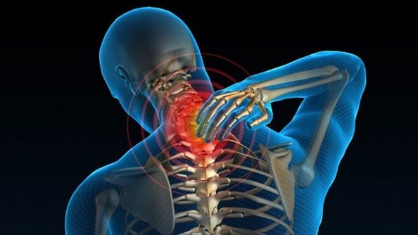 El dolor al girar el cuello puede indicar síndrome de osteocondrosis vertebral cervical